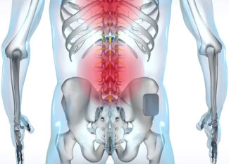 agrilarda-girisimsel-tedavi
